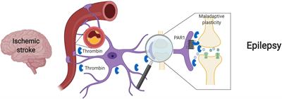 Post Stroke Seizures and Epilepsy: From Proteases to Maladaptive Plasticity